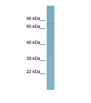 Polyclonal Rabbit anti-Human ABCB7 Antibody (aa593-642, WB)