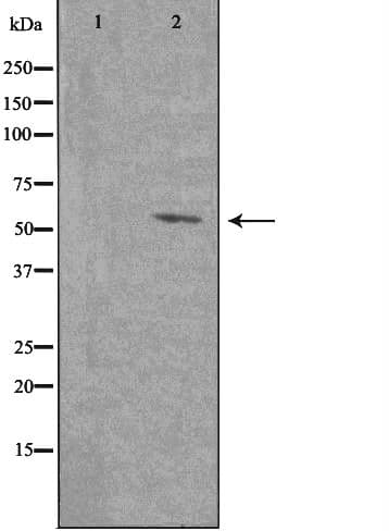 Polyclonal Rabbit anti-Human PTGER4 / EP4 Antibody (IF, WB)