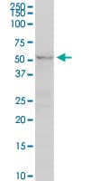 Monoclonal Mouse anti-Human UGT2B7 Antibody (clone 8D12, WB)