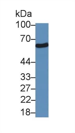 SUOX / Sulfite Oxidase Antibody (aa80-545)