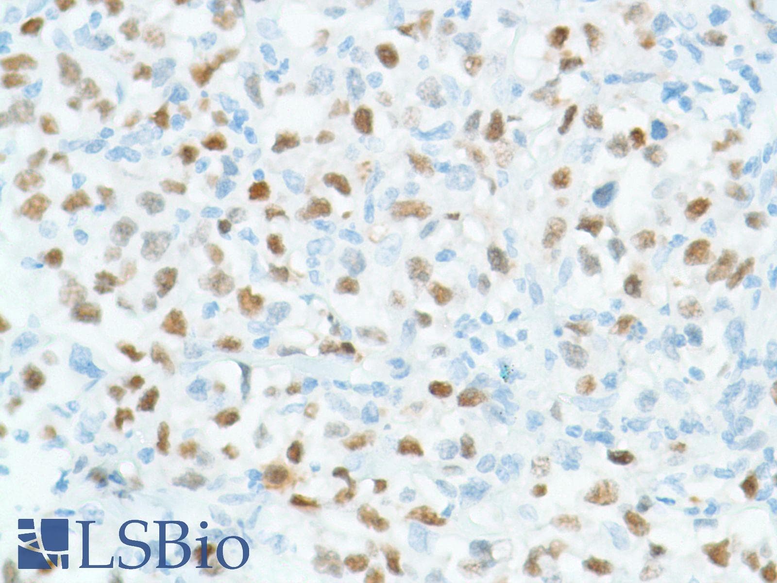 Monoclonal Rabbit anti-Human BCL6 Antibody (clone SP155, C-Terminus, IHC)