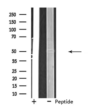 EIF2B3 Antibody
