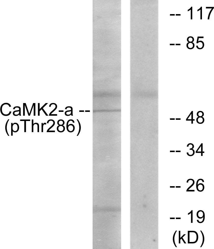 CAMK2 / CAMKII Antibody (phospho-Thr286)