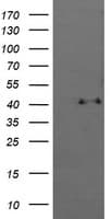 MAPK13 / p38delta Antibody (clone OTI12B12, Carrier-free)