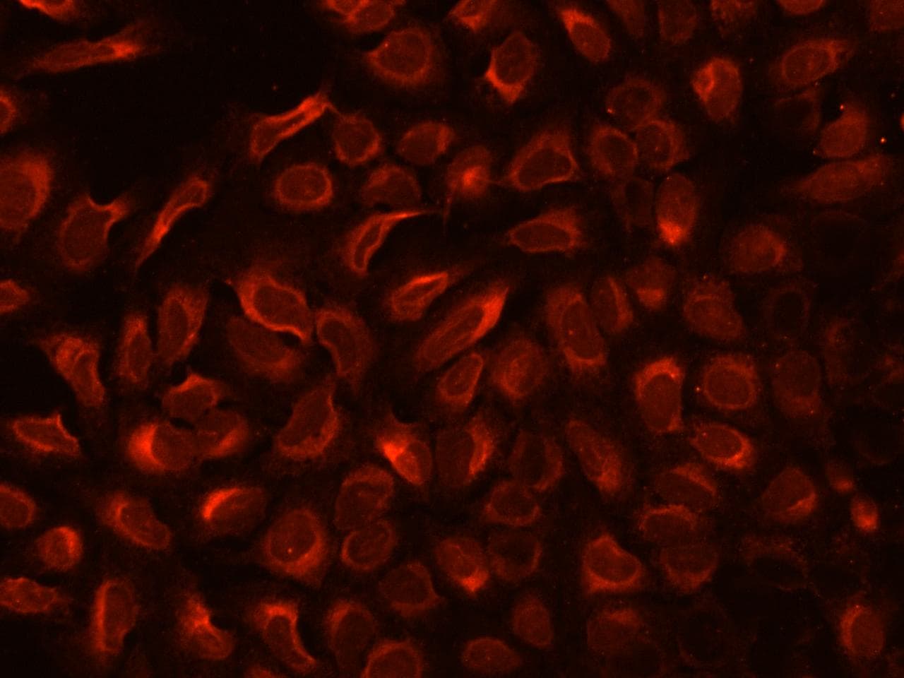 TXNDC5 / ERP46 Antibody