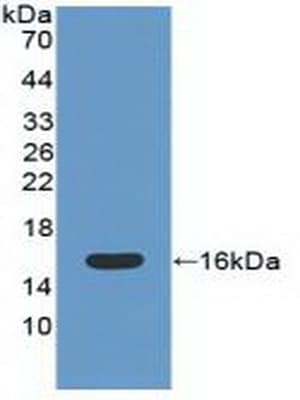 CAT / Catalase Antibody (aa32-157, HRP)