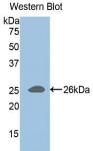 ADAMTS1 Antibody (aa258-467)