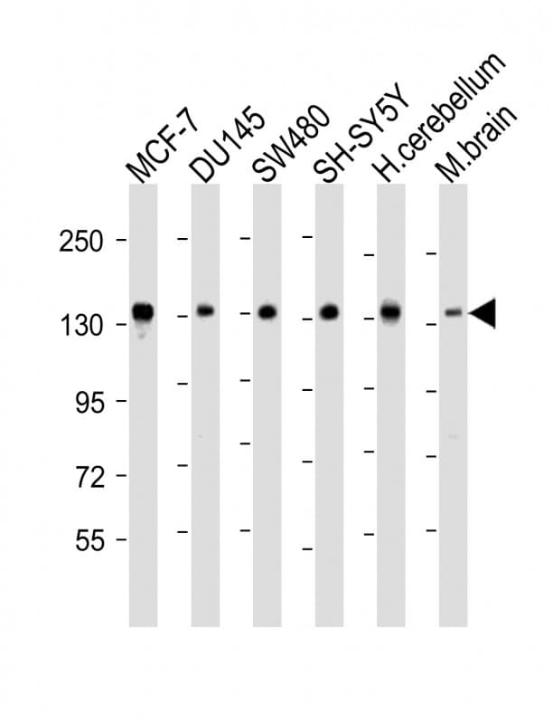 SRGAP2 Antibody (aa1040-1071)