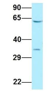 DYRK2 Antibody (aa434-483)