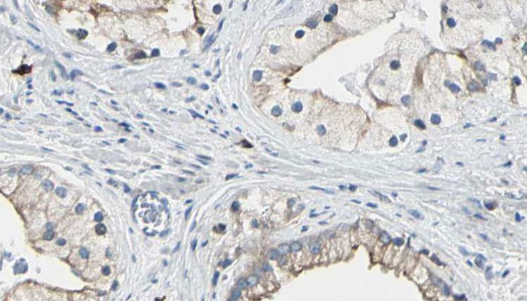 DVL1 / DVL / Dishevelled Antibody