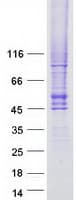 Human SLC2A4 / GLUT-4 Protein (Recombinant Myc-DDK (Flag))