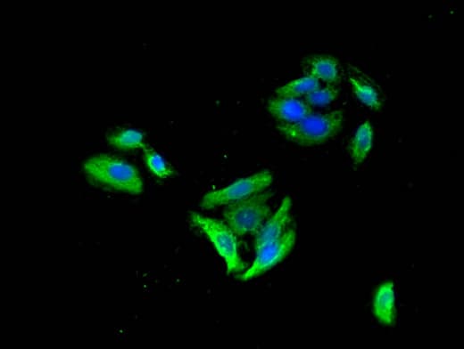 GABRB3 Antibody