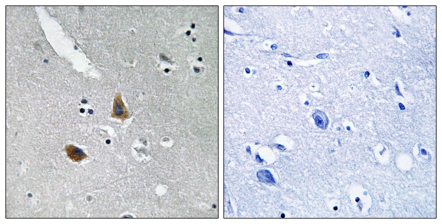 MRPL21 Antibody
