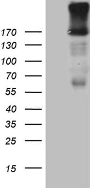 Monoclonal Mouse anti-Human EGF Antibody (clone OTI8E2, aa1054-1207, WB)