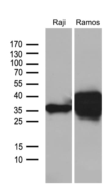 CD79B / CD79 Beta Antibody (clone OTI8A12)