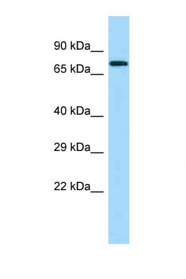 Polyclonal Rabbit anti-Human PICALM / CALM Antibody (aa277-326, WB)
