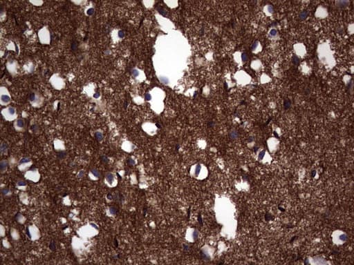 Monoclonal Mouse anti-Human NCAM / CD56 Antibody (clone OTI3H2, Carrier-free, aa20-718, IHC, WB)