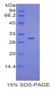 Rabbit CETP Protein (Recombinant His)