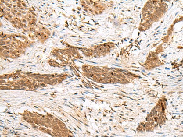 NUPL1 Antibody