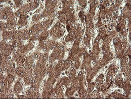 STK38L / NDR2 Antibody (clone OTI4D8)