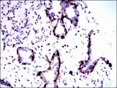 KRT5 / CK5 / Cytokeratin 5 Antibody (aa316-590, clone 10C11E6)