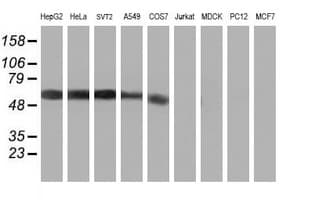 KCNJ3 / GIRK1 Antibody (clone OTI3E11)