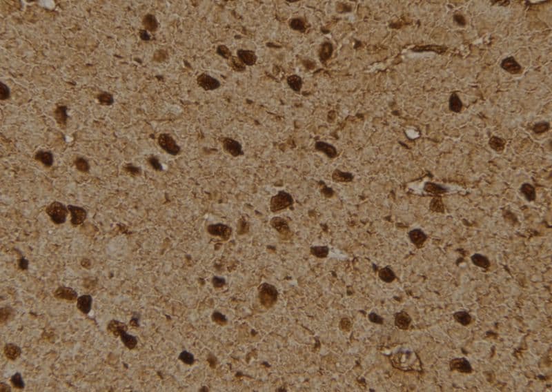PSMD4 / RPN10 Antibody