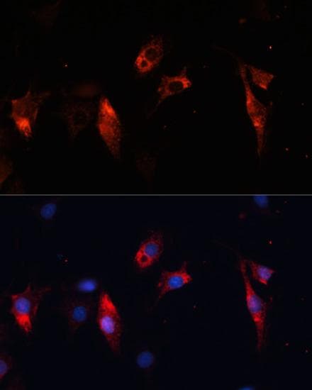 CTSL / Cathepsin L Antibody