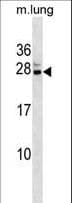 CBX5 / HP1 Alpha Antibody (aa160-186)