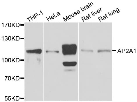 AP2A1 / AP2-Alpha Antibody (AP)