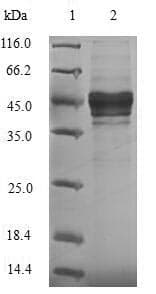 Outer capsid glycoprotein VP7 (Rotavirus A) (Recombinant 6His-B2M, N-terminus)
