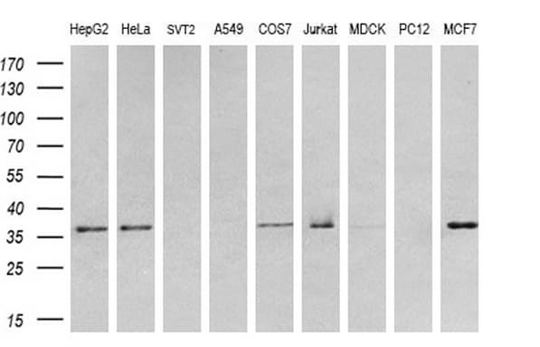 TRB3 / TRIB3 Antibody (aa1-200, clone OTI3F6)