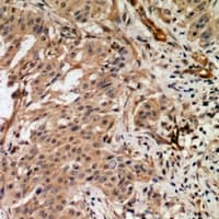 RAB3GAP2 / p150 Antibody