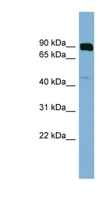 Polyclonal Rabbit anti-Human PSEN1 / Presenilin 1 Antibody (aa107-156, IHC, WB)
