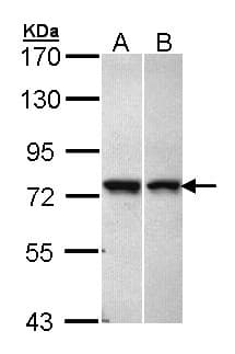 C11orf2 / Fat-Free Antibody (aa489-721)