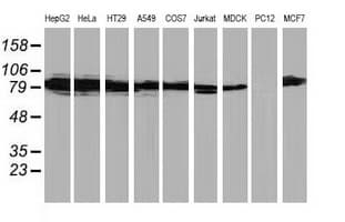 PRKCE / PKC-Epsilon Antibody (clone OTI2A12)