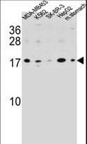 Polyclonal Rabbit anti-Human S100Z Antibody (aa1-30, WB)