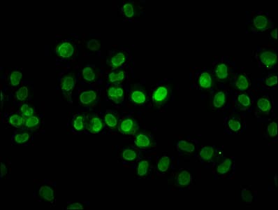 HIST1H2BN Antibody