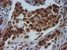 TIMP2 Antibody (clone OTI1A6, Carrier-free)