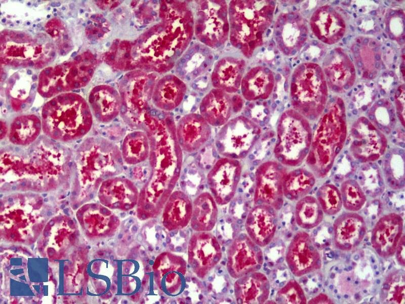 IHC-plus™ ATP6V1B2 Antibody (clone 2A5)