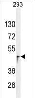 Polyclonal Rabbit anti-Human OR13J1 Antibody (aa244-272, IHC, WB)
