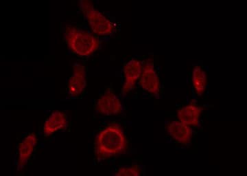 Polyclonal Rabbit anti-Human ZP1 Antibody (IF, WB)