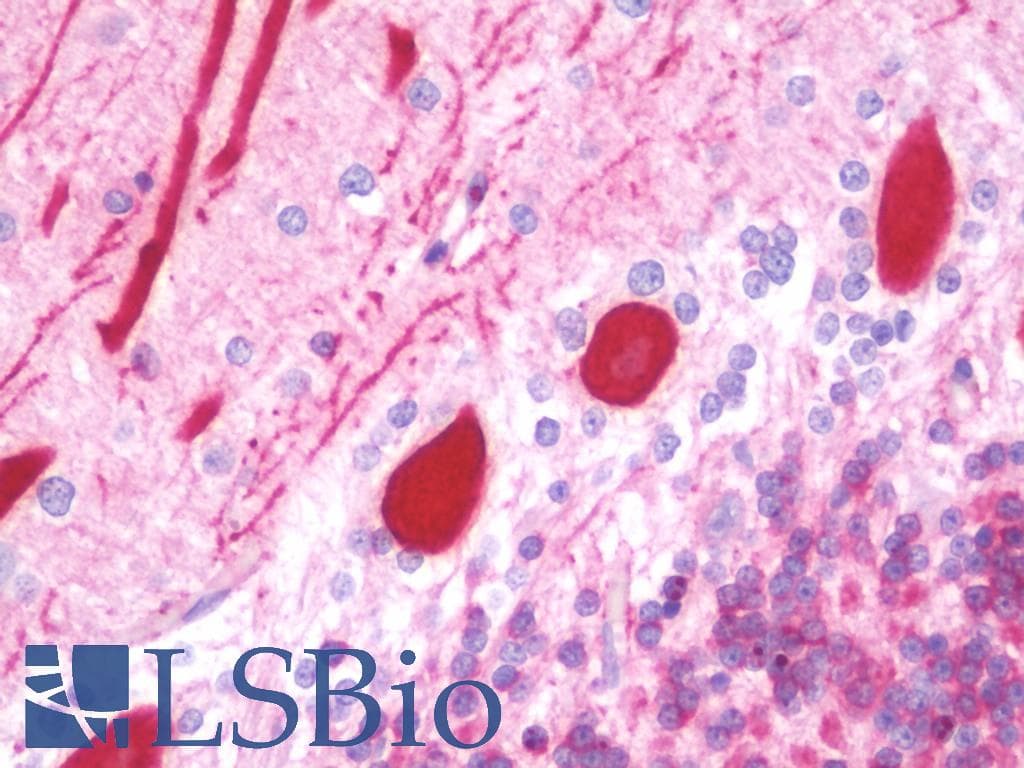 IHC-plus™ DAB1 Antibody (aa191-240)