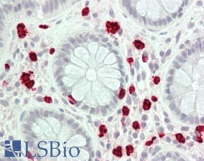 ALOX15 / 15-Lipoxygenase Antibody (clone 7H6, Carrier-free)