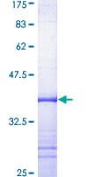 Human KCNN4 / KCa3.1 Protein (Recombinant GST, N-terminus)