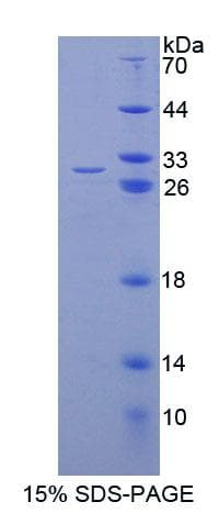 Human TCEA2 / TFIIS Protein (Recombinant His-T7, N-terminus)