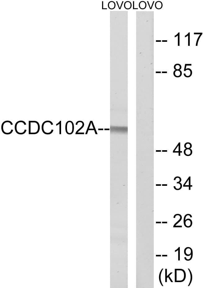 CCDC102A Antibody (aa341-390)