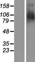 ARTS1 / ERAP1 Protein (Over-Expression Lysate Myc-DDK (Flag))