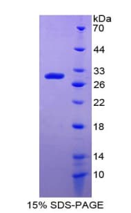 Human DDB2 Protein (Recombinant 6His, N-terminus)