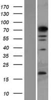 PHF14 Protein (Over-Expression Lysate Myc-DDK (Flag))